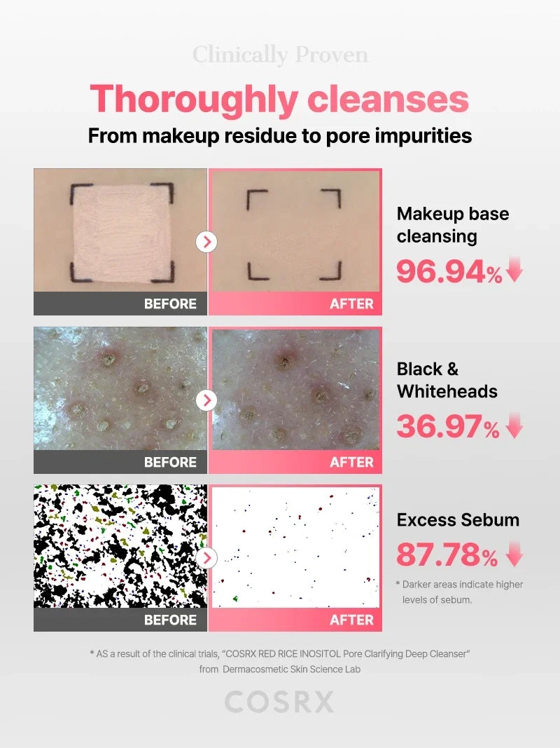 COSRX RED RICE INOSITOL Pore Clarifying Deep Cleanser